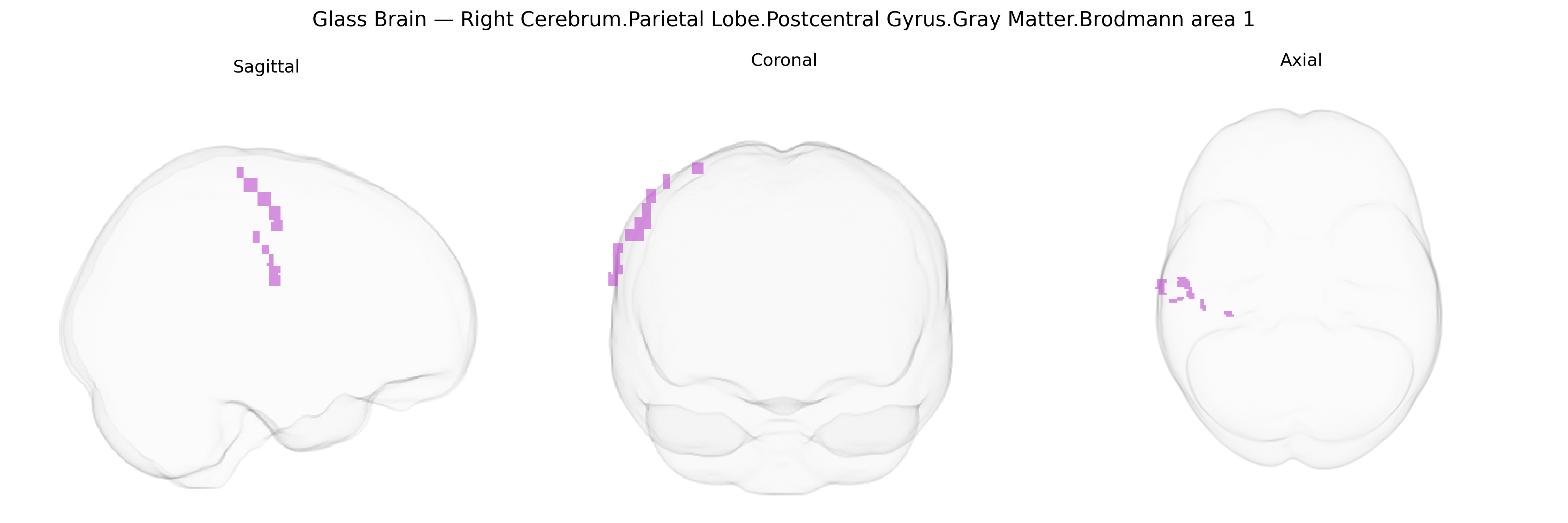 Triplanar Ghost Brain