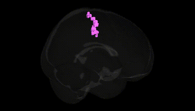 Full Brain Black