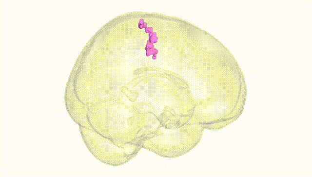 Full Brain White