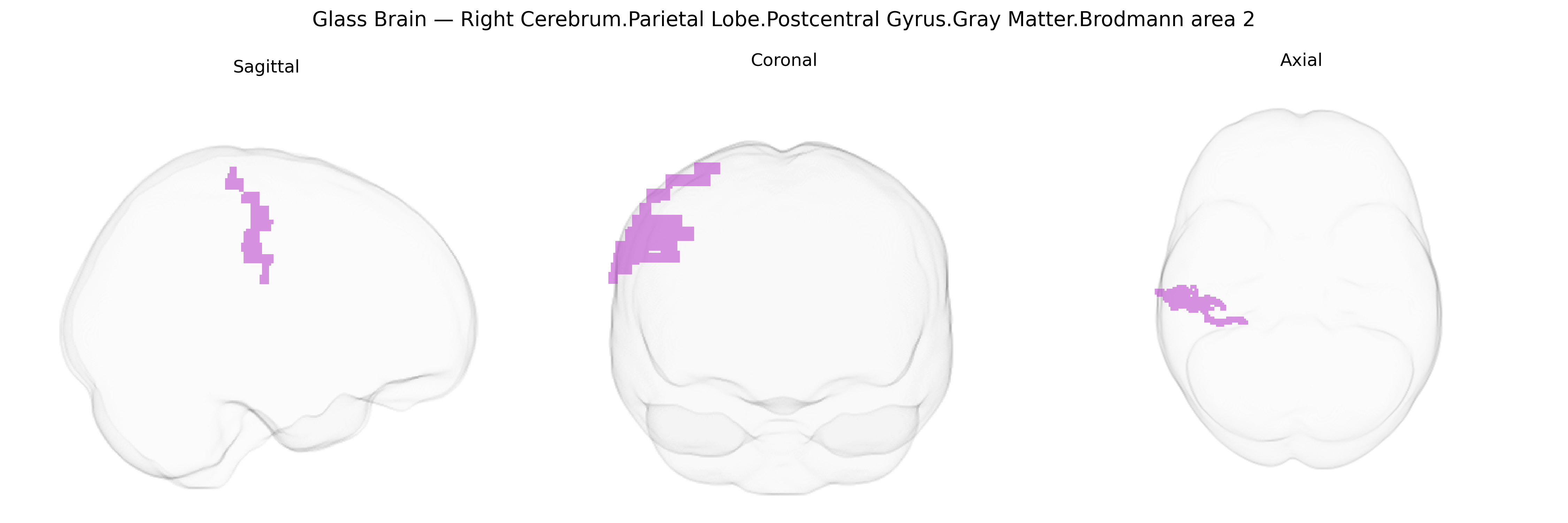 Triplanar Ghost Brain