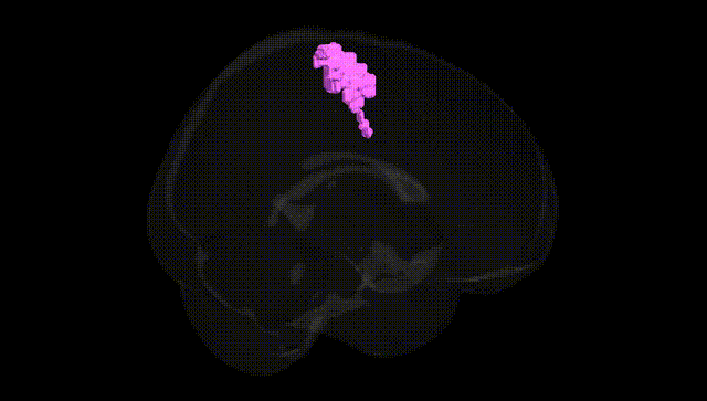 Full Brain Black