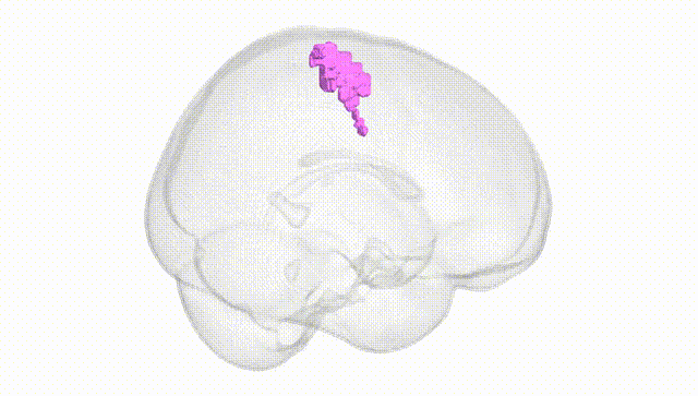 Full Brain White