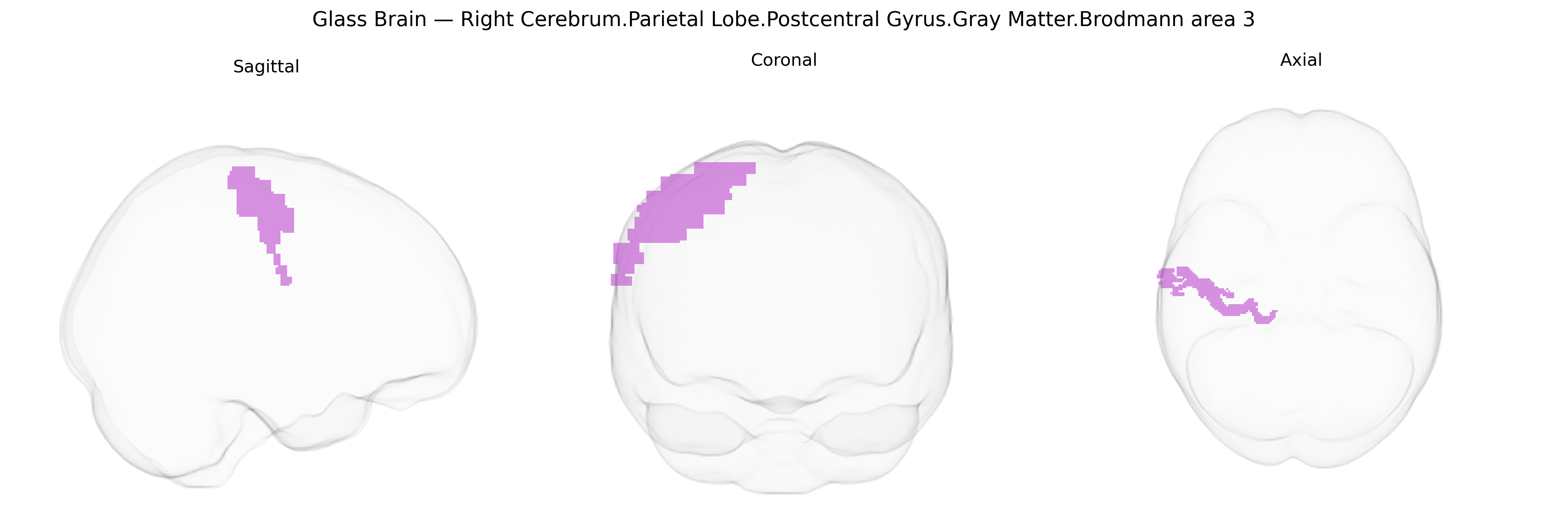 Triplanar Ghost Brain