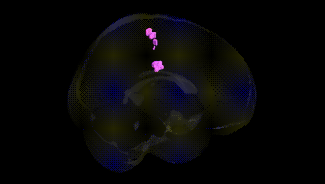 Full Brain Black