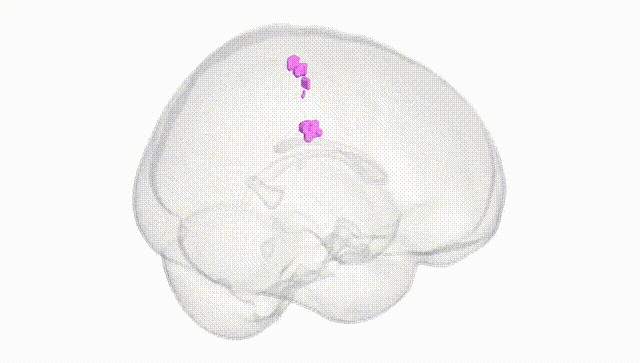 Full Brain White