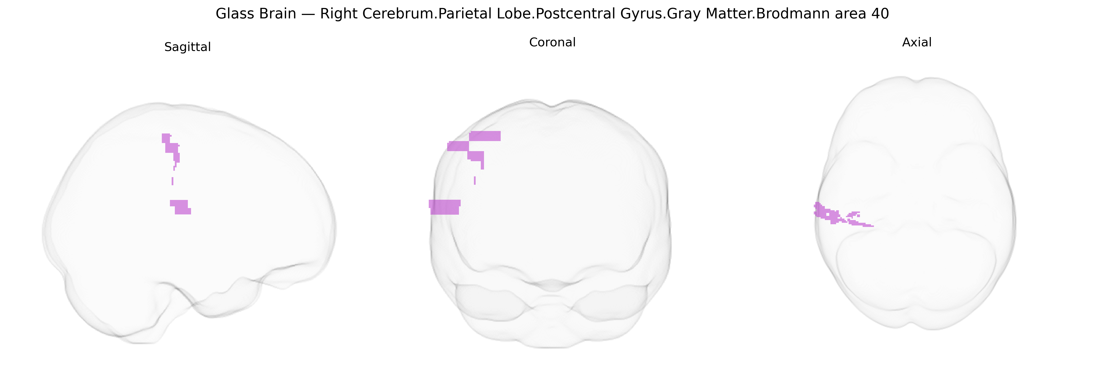 Triplanar Ghost Brain