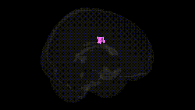 Full Brain Black