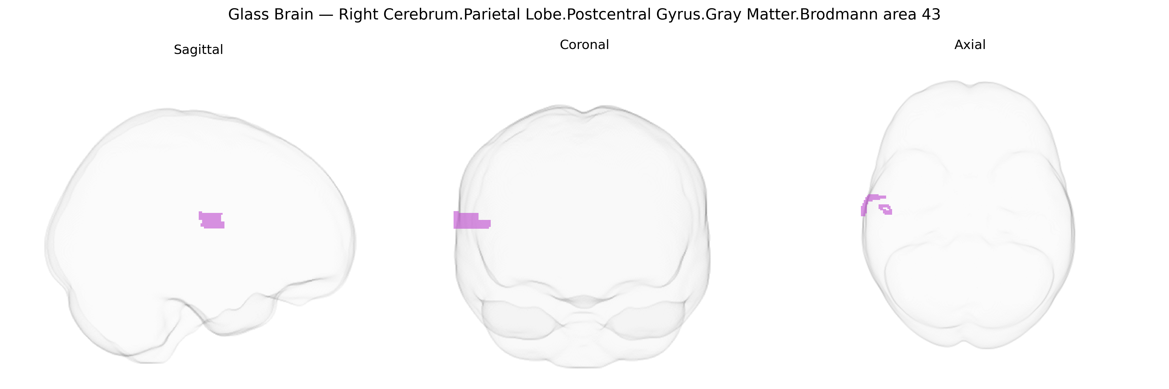 Triplanar Ghost Brain