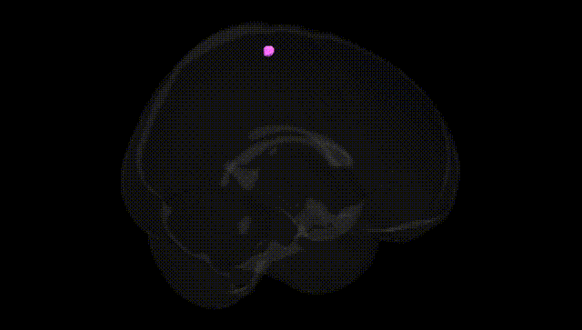 Full Brain Black