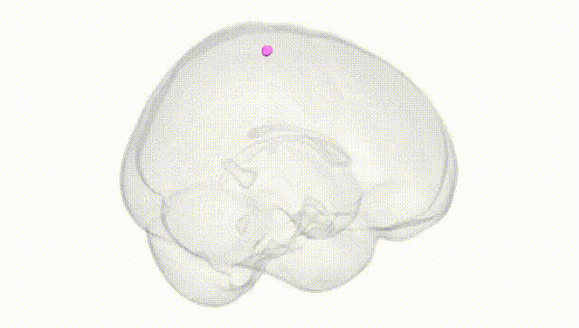Full Brain White