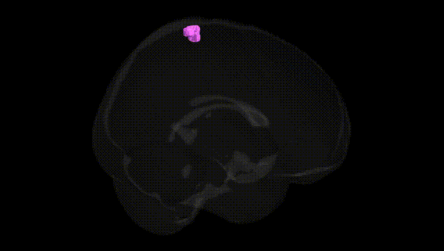 Full Brain Black