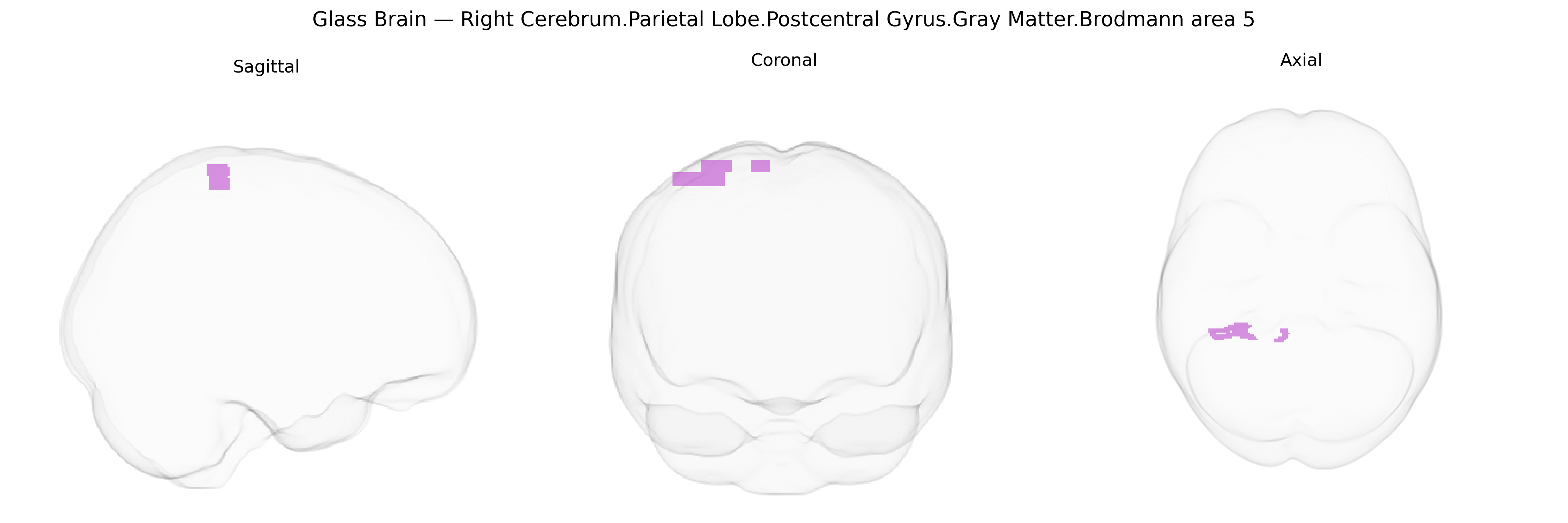 Triplanar Ghost Brain