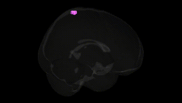 Full Brain Black