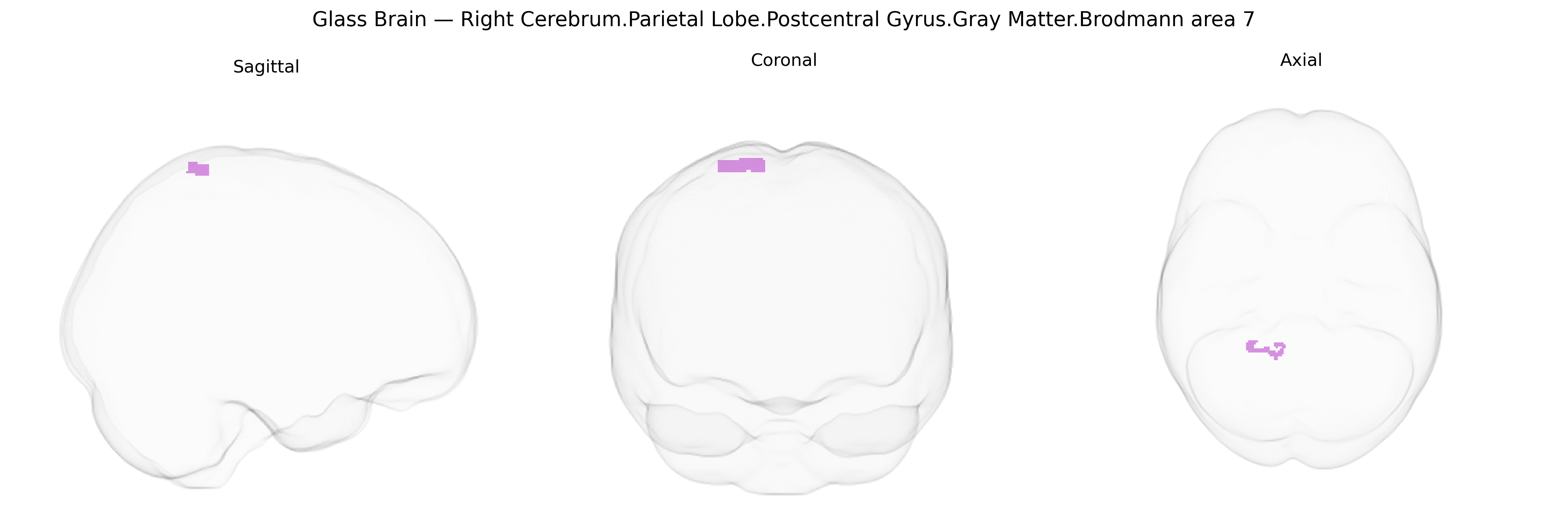 Triplanar Ghost Brain
