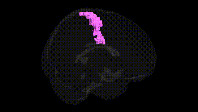 Full Brain Black