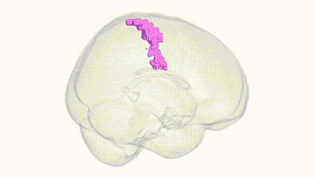 Full Brain White