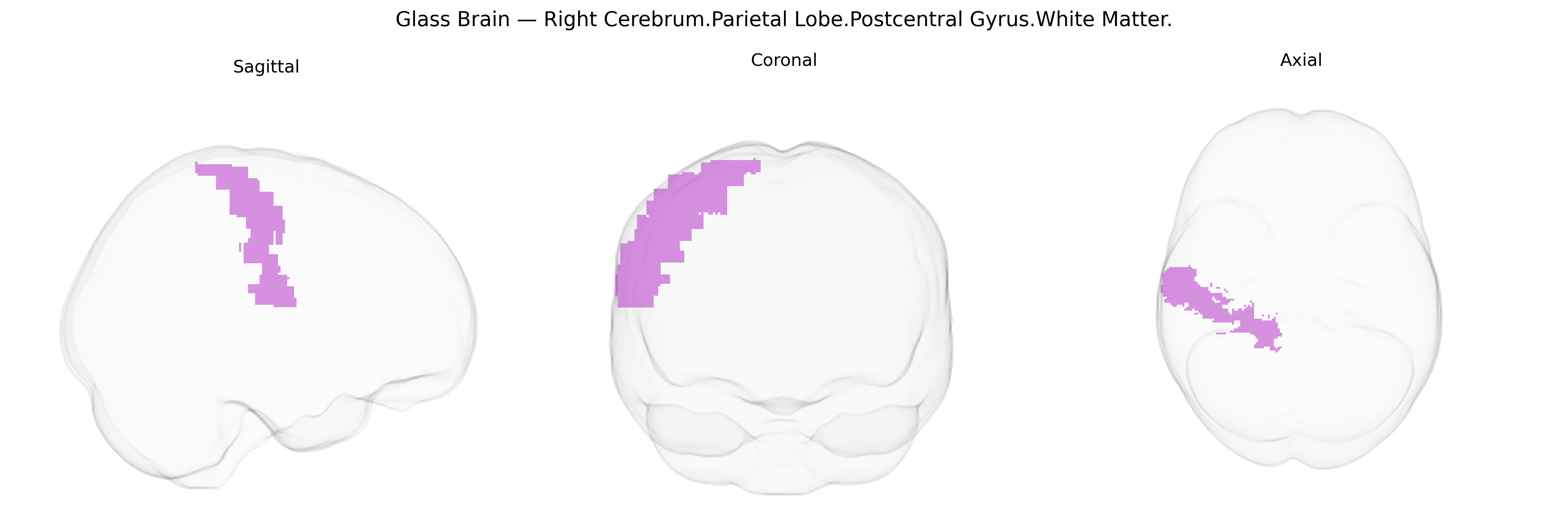 Triplanar Ghost Brain