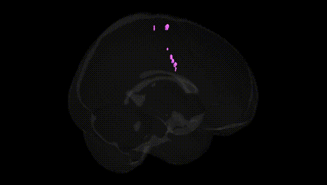 Full Brain Black