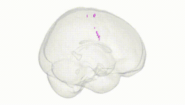 Full Brain White
