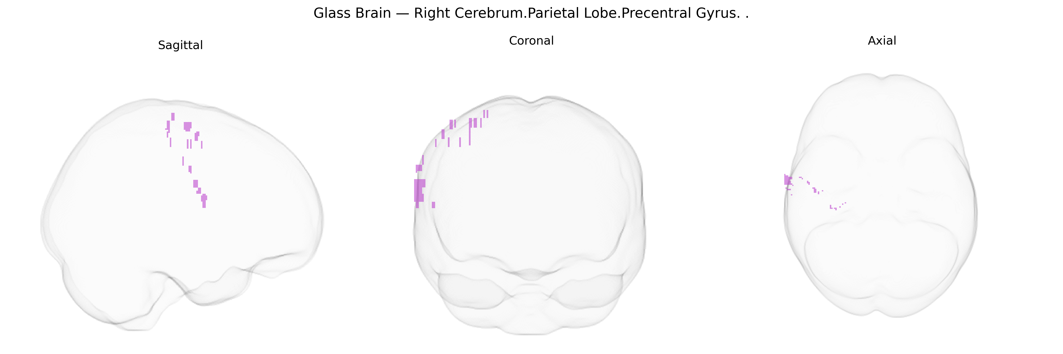 Triplanar Ghost Brain