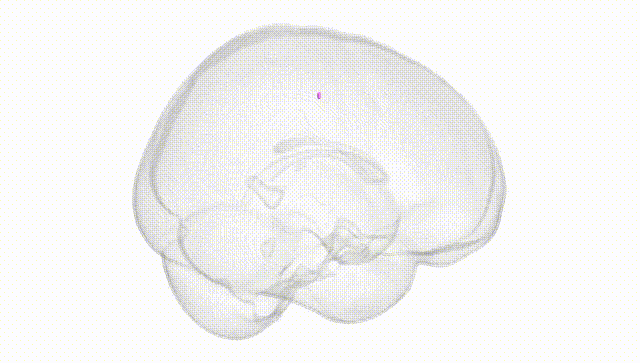 Full Brain White