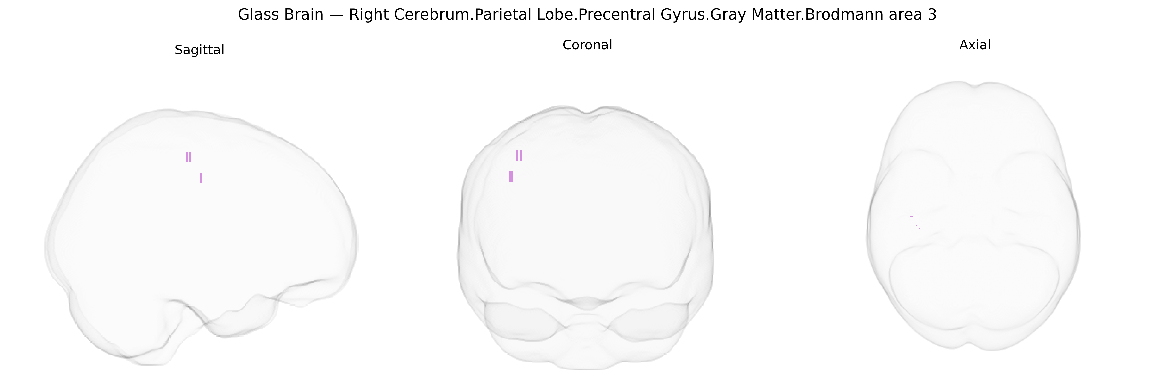 Triplanar Ghost Brain