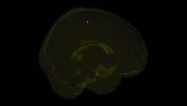 Full Brain Black