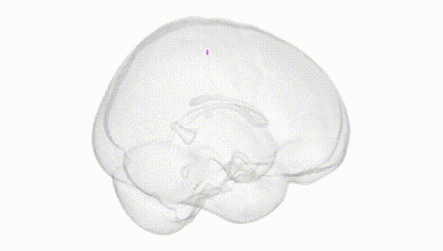 Full Brain White