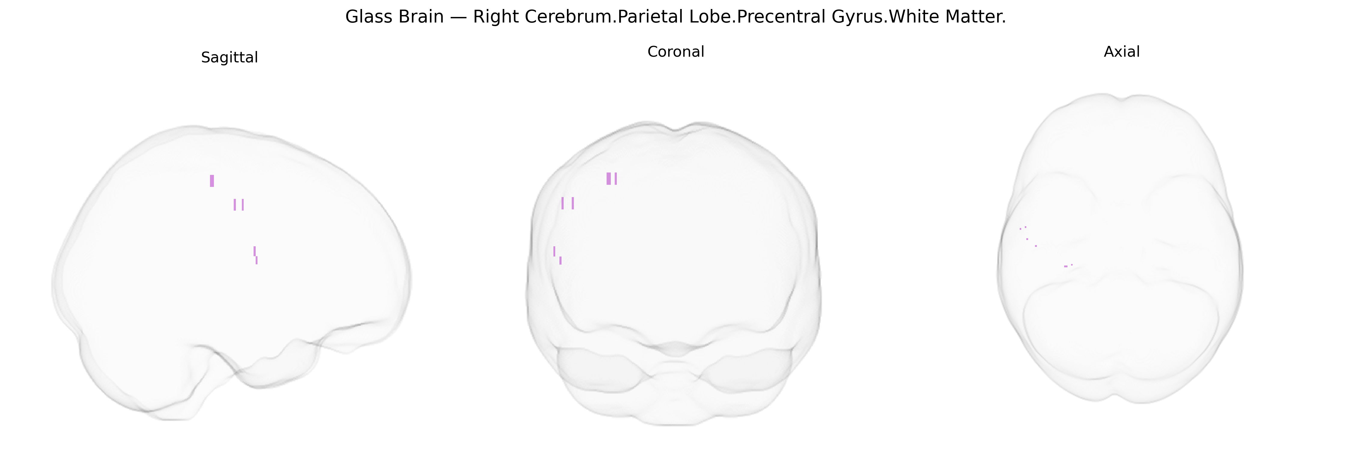 Triplanar Ghost Brain