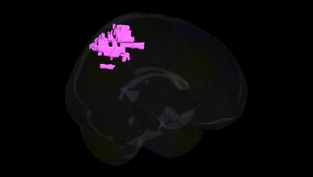 Full Brain Black