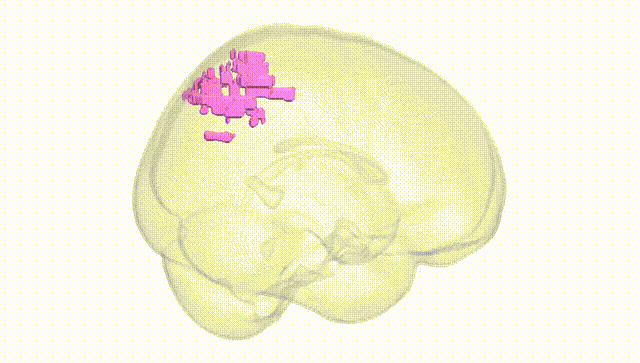 Full Brain White