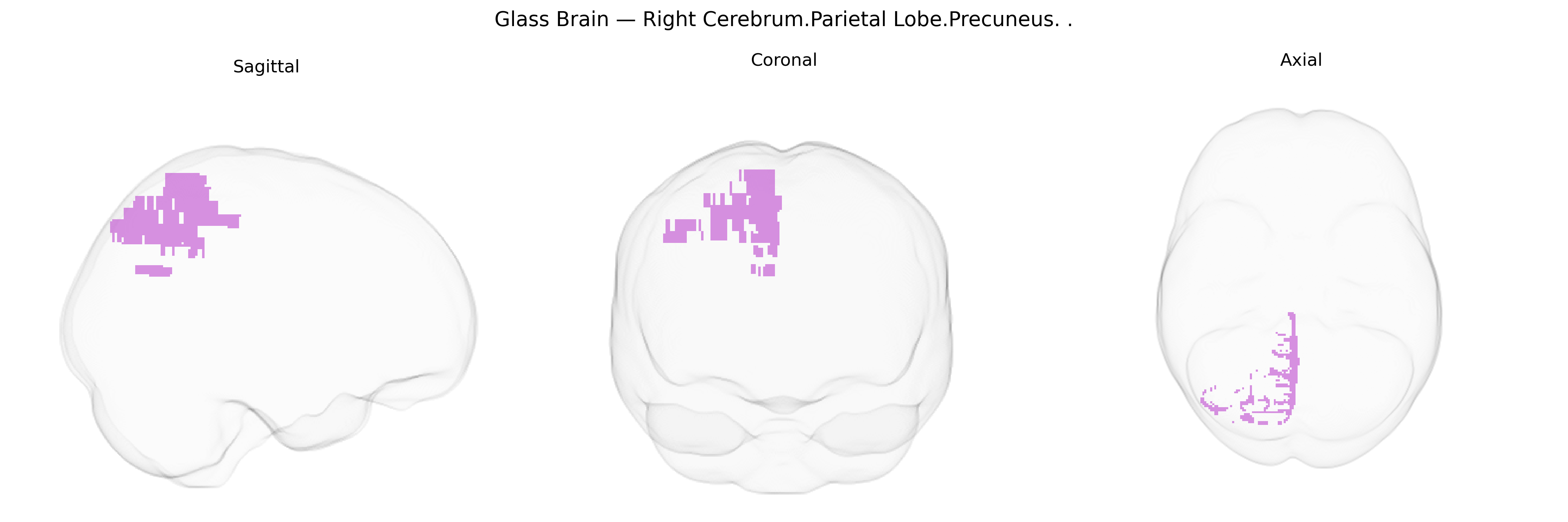 Triplanar Ghost Brain