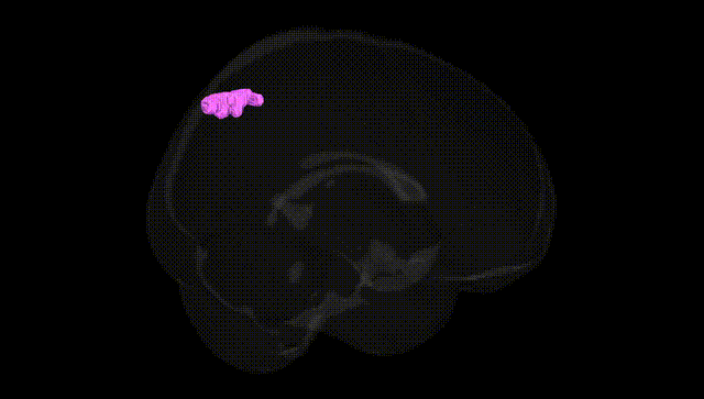 Full Brain Black