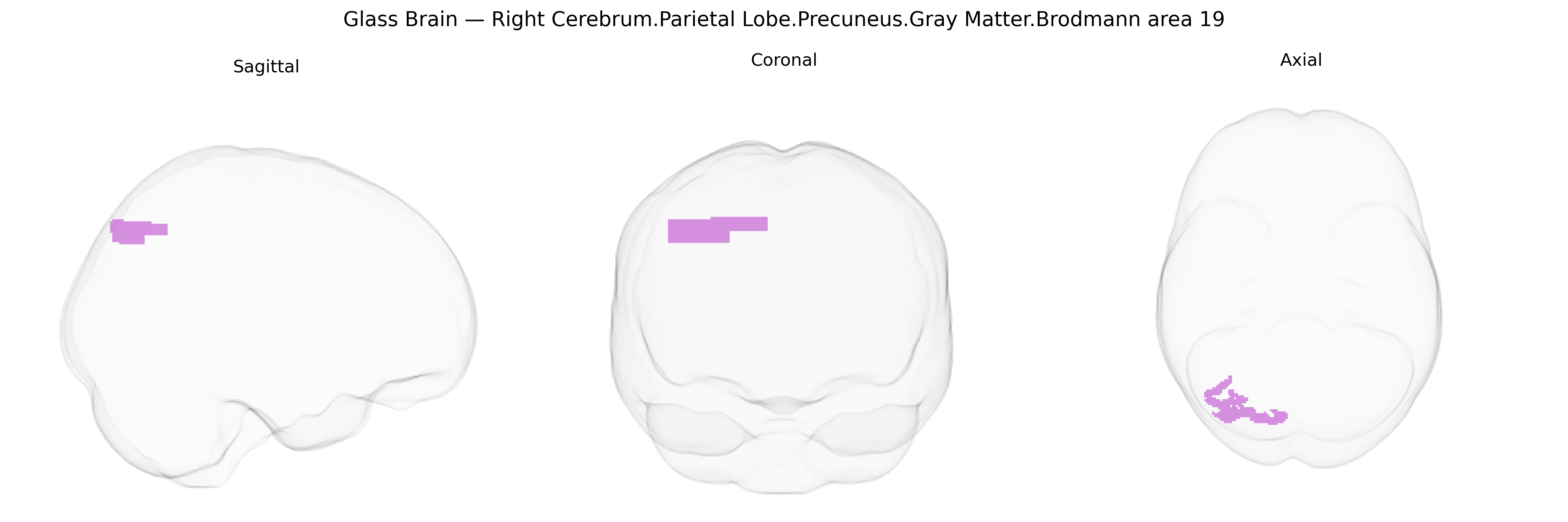 Triplanar Ghost Brain