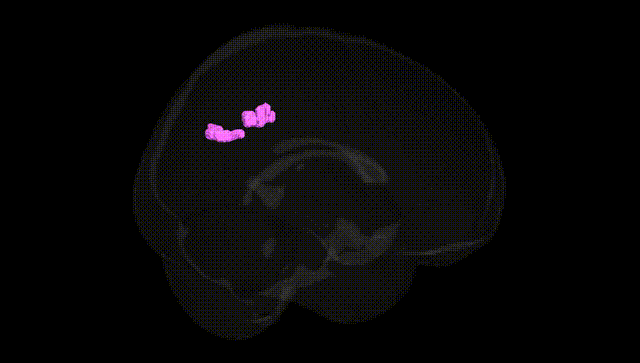 Full Brain Black