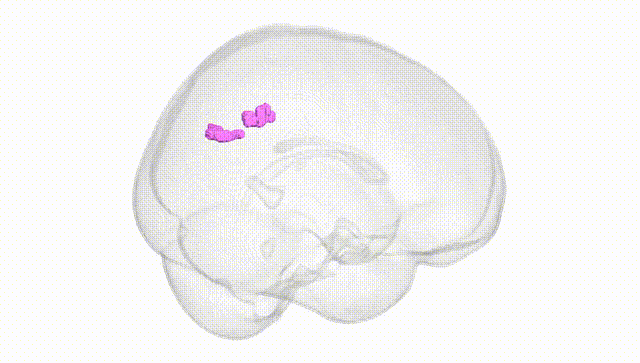 Full Brain White