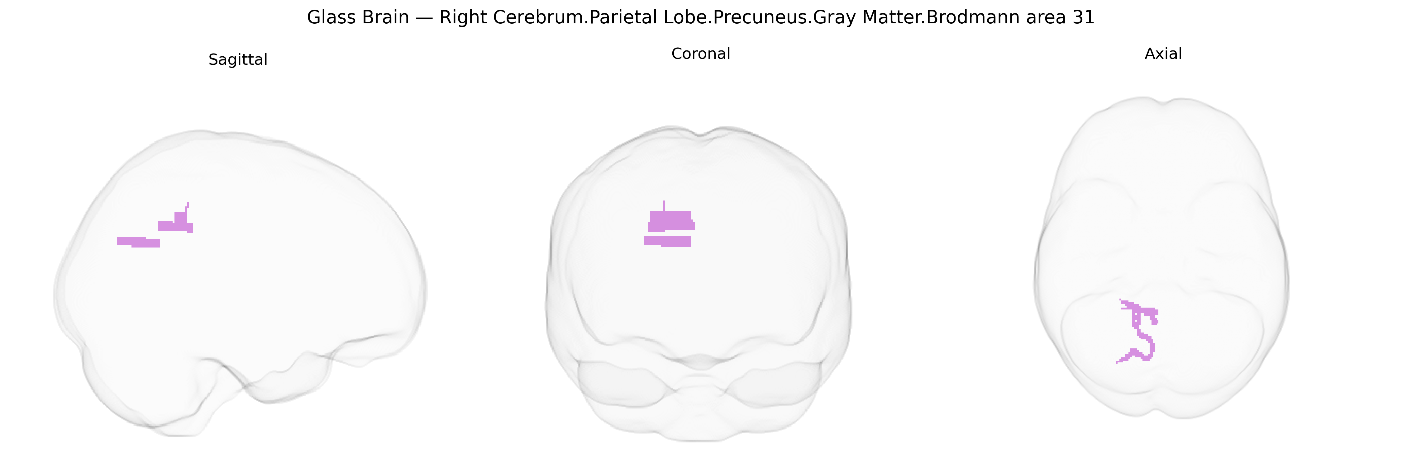 Triplanar Ghost Brain