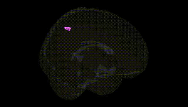 Full Brain Black