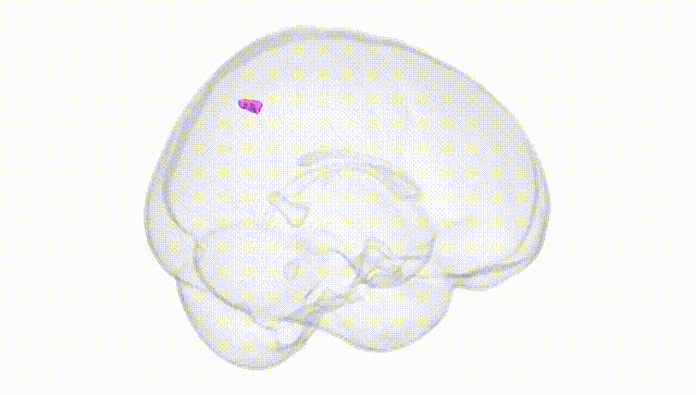 Full Brain White