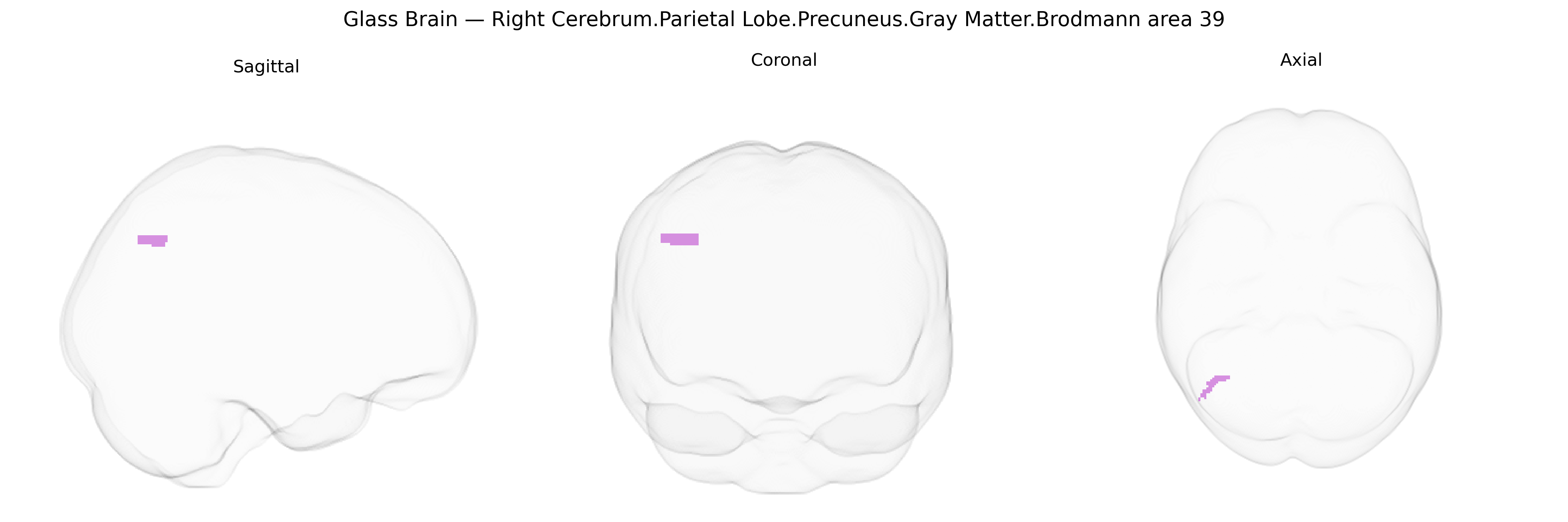 Triplanar Ghost Brain