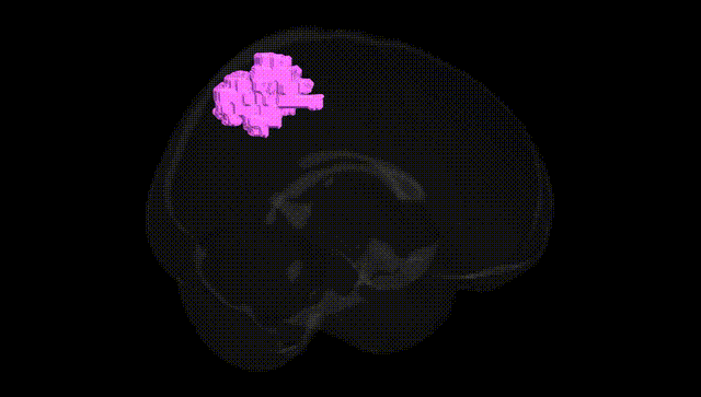 Full Brain Black