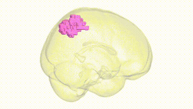 Full Brain White