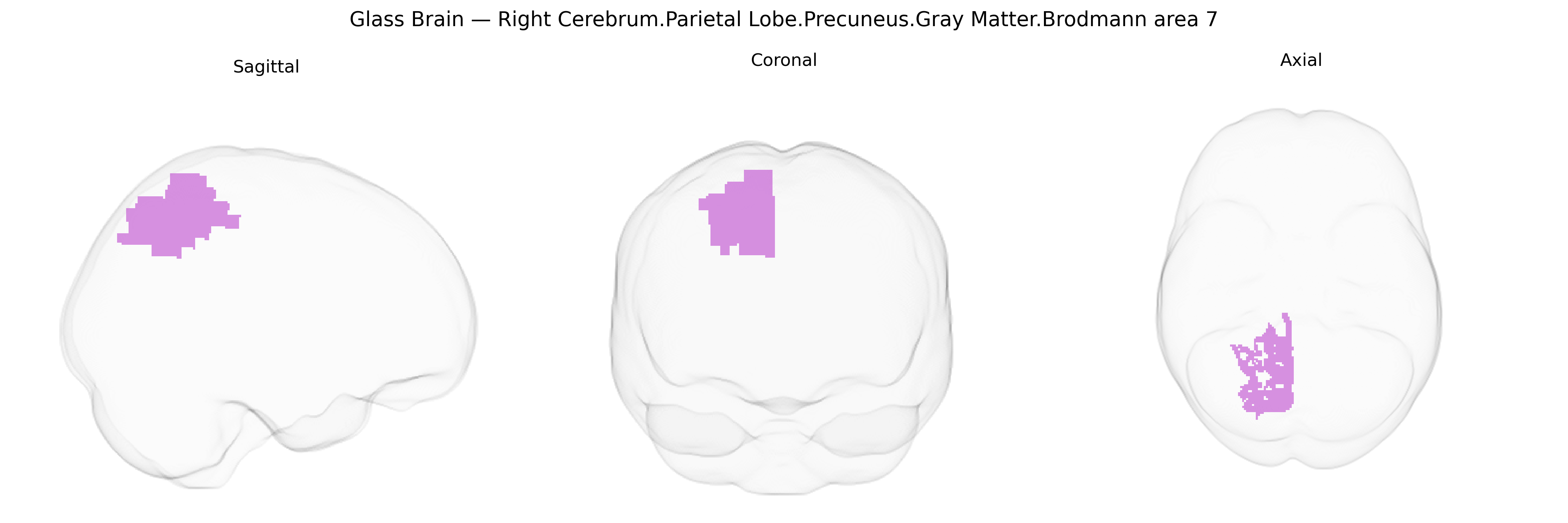 Triplanar Ghost Brain