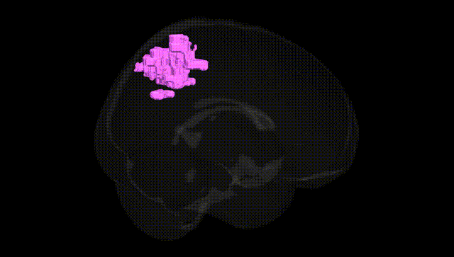 Full Brain Black