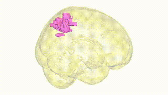 Full Brain White