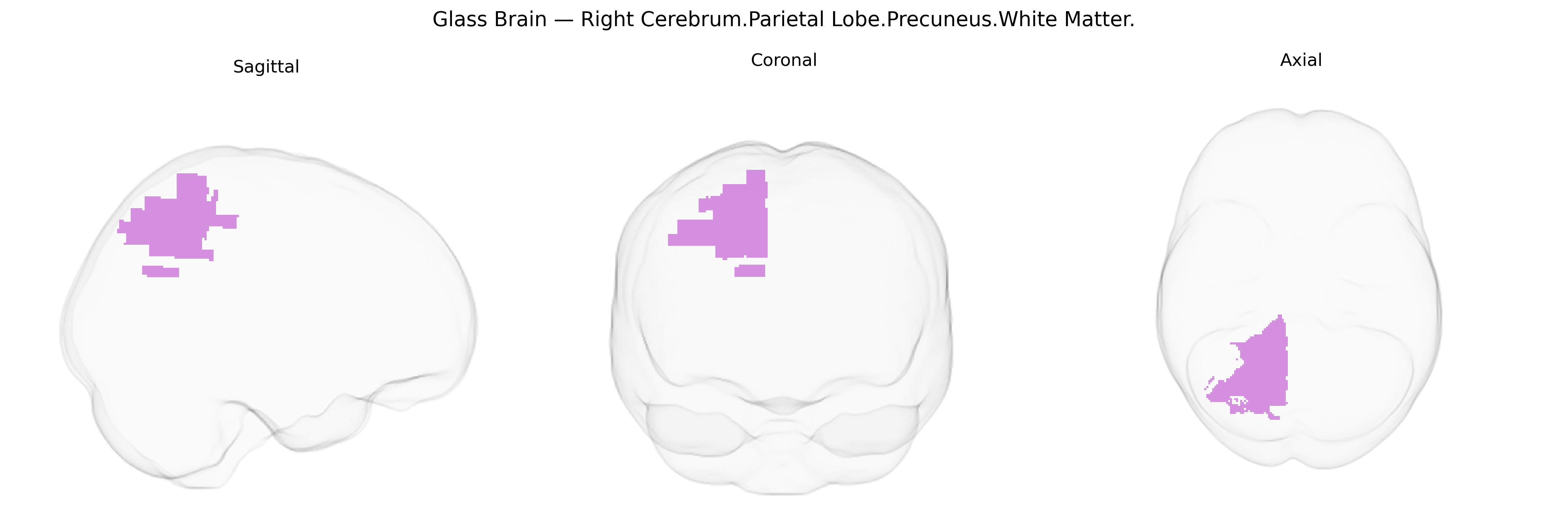 Triplanar Ghost Brain