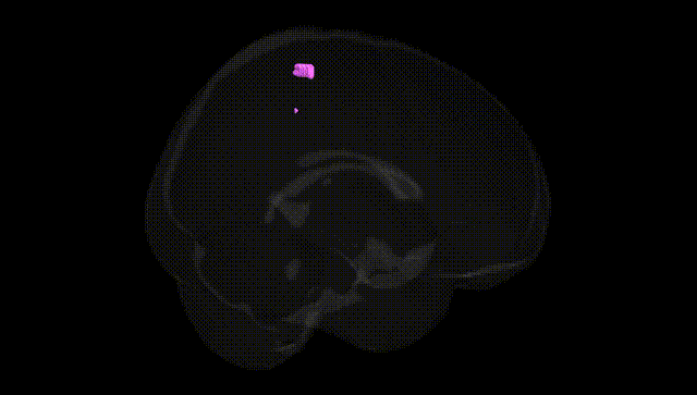 Full Brain Black