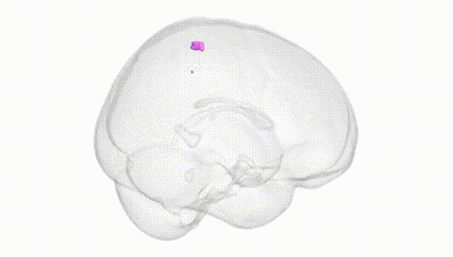 Full Brain White