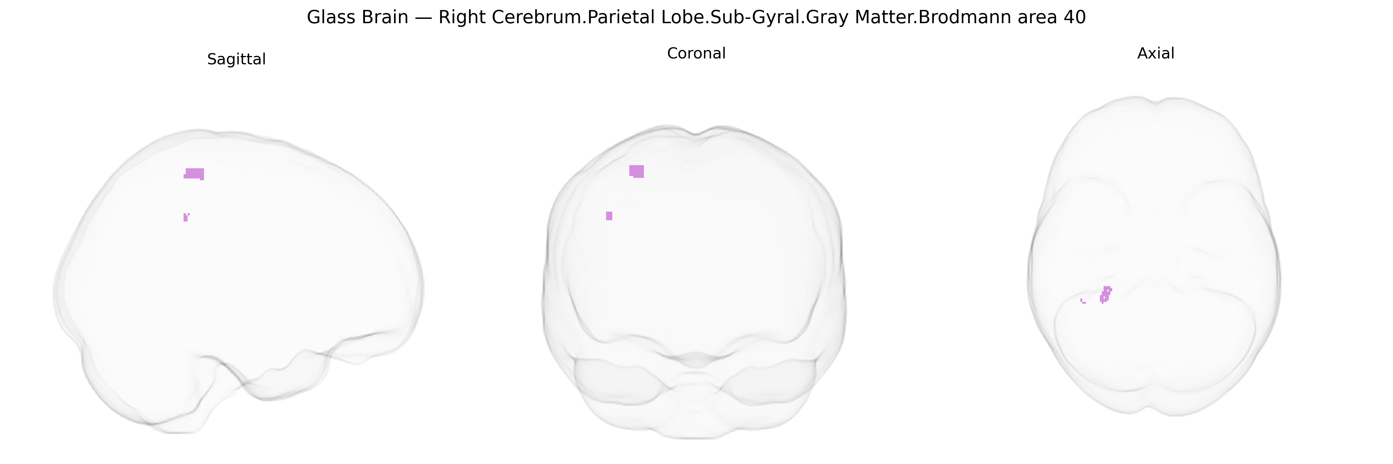 Triplanar Ghost Brain