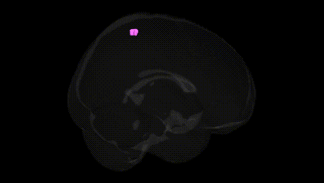 Full Brain Black